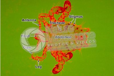 Pthirus pubis. Crab louse. Pediculosis pubis. Dorsal view
