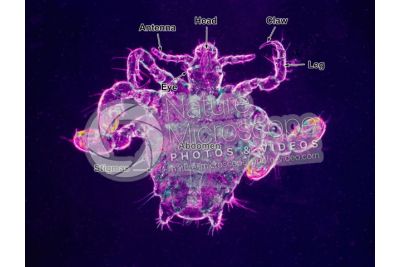 Pthirus pubis. Crab louse. Pediculosis pubis. Dorsal view