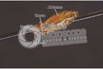 Pediculus humanus capitis. Head louse. Pediculosis. Dorsal view