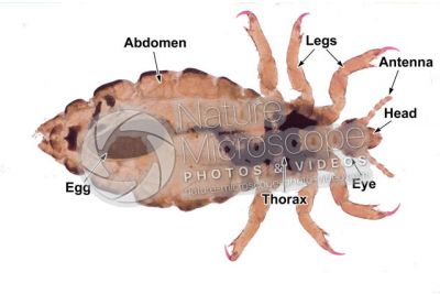 Pediculus humanus capitis. Head louse. Pediculosis. Ventral view