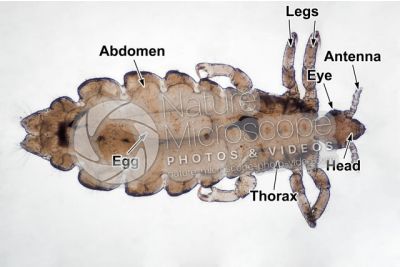 Pediculus humanus capitis. Head louse. Pediculosis. Dorsal view