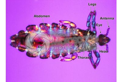 Pediculus humanus capitis. Head louse. Pediculosis. Dorsal view