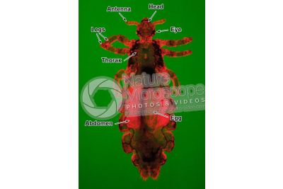 Pediculus humanus capitis. Head louse. Pediculosis. Dorsal view