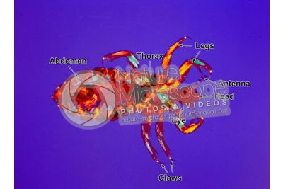 Pediculus humanus capitis. Head louse. Pediculosis. Ventral view