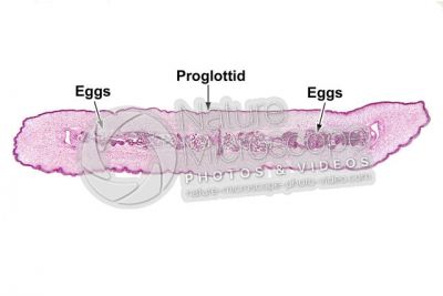 Taenia solium. Tapeworm. Taeniasis. Transverse section. 5X