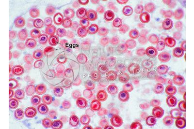Taenia solium. Tapeworm. Taeniasis. Transverse section. 125X
