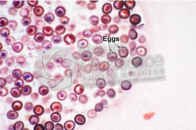 Taenia solium. Tapeworm. Taeniasis. Transverse section. 125X