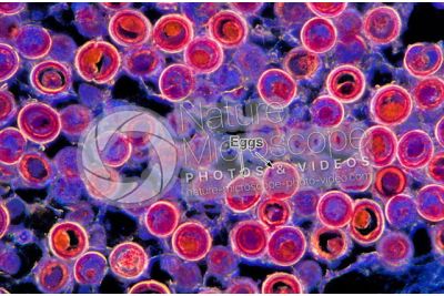 Taenia solium. Tapeworm. Taeniasis. Transverse section. 250X