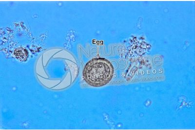 Taenia solium. Tapeworm. Taeniasis. Transverse section. 400X