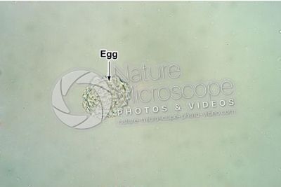 Ascaris lumbricoides. Ascariasis. 250X