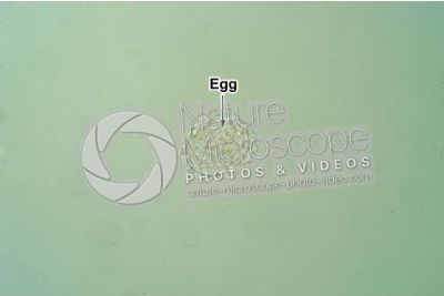 Ascaris lumbricoides. Ascariasis. 250X