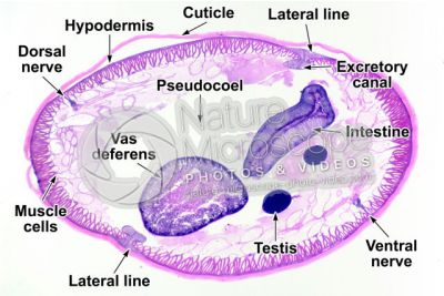 Ascaris megalocephala. Ascariasis. Male. Transverse section. 32X