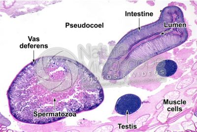 Ascaris megalocephala. Ascariasis. Male. Transverse section. 64X