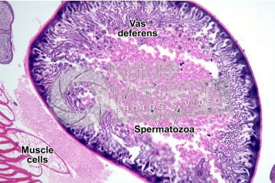 Ascaris megalocephala. Ascariasis. Male. Vas deferens. Transverse section. 125X