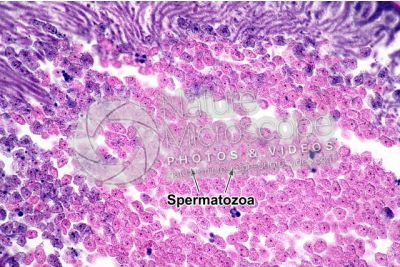 Ascaris megalocephala. Ascariasis. Male. Vas deferens. Transverse section. 250X