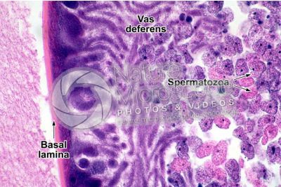 Ascaris megalocephala. Ascariasis. Male. Vas deferens. Transverse section. 500X