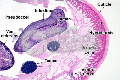 Ascaris megalocephala. Ascariasis. Male. Transverse section. 64X