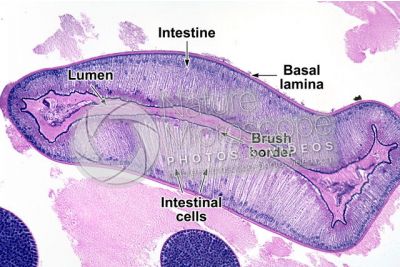 Ascaris megalocephala. Ascariasis. Male. Intestine. Transverse section. 125X