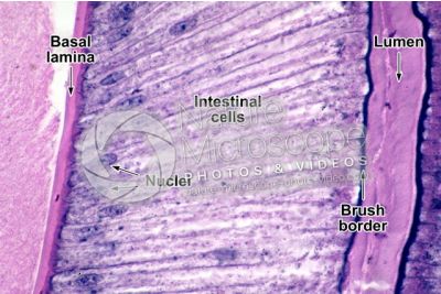Ascaris megalocephala. Ascariasis. Male. Intestine. Transverse section. 500X