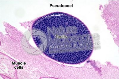 Ascaris megalocephala. Ascariasis. Male. Testis. Transverse section. 250X