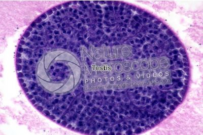 Ascaris megalocephala. Ascariasis. Male. Testis. Transverse section. 500X
