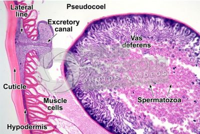 Ascaris megalocephala. Ascariasis. Male. Transverse section. 125X