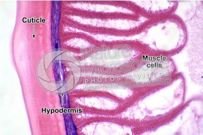 Ascaris megalocephala. Ascariasis. Male. Transverse section. 500X