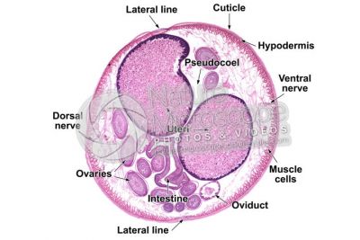 Ascaris megalocephala. Ascariasis. Female. Transverse section. 32X