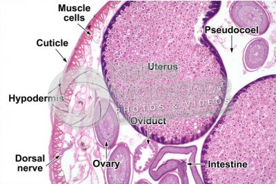 Ascaris megalocephala. Ascariasis. Female. Transverse section. 32X