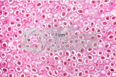 Ascaris megalocephala. Ascariasis. Female. Uterus. Transverse section. 125X