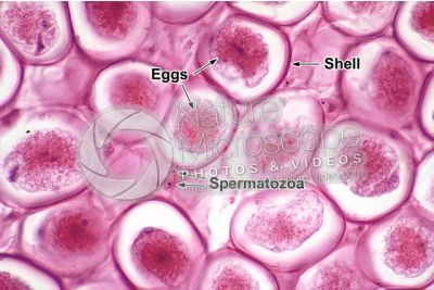 Ascaris megalocephala. Ascariasis. Female. Uterus. Transverse section. 500X