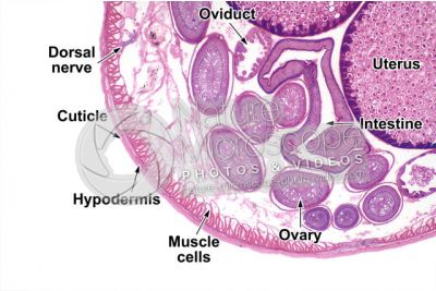 Ascaris megalocephala. Ascariasis. Female. Transverse section. 32X