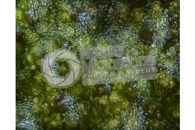 Marchantia polymorpha. Common liverwort. Antheridiophore. 60X