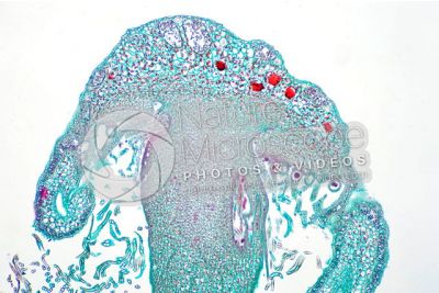 Marchantia polymorpha. Common liverwort. Archegonium in intermediate stage. Longitudinal section. 64X