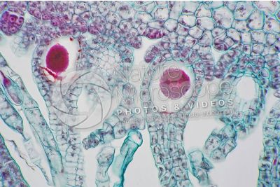Marchantia polymorpha. Common liverwort. Archegonium in intermediate stage. Longitudinal section. 500X