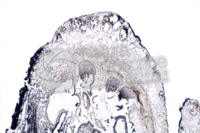 Marchantia polymorpha. Common liverwort. Archegonium. Longitudinal section. 32X