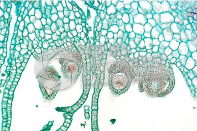 Marchantia polymorpha. Common liverwort. Zygote. Longitudinal section. 250X