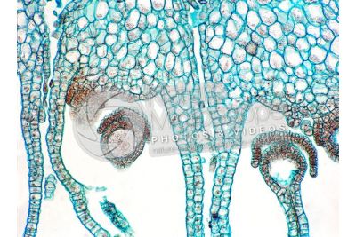 Marchantia polymorpha. Common liverwort. Zygote. Longitudinal section. 250X