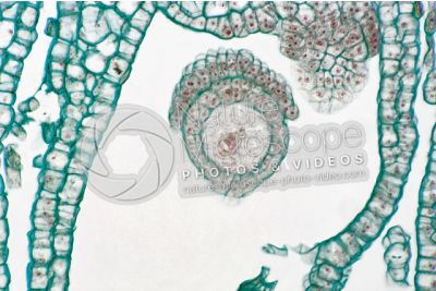 Marchantia polymorpha. Common liverwort. Zygote. Longitudinal section. 500X