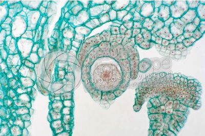 Marchantia polymorpha. Common liverwort. Zygote. Longitudinal section. 500X