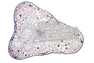 Psilotum nudum. Whisk fern. Stem. Protostele. Transverse section. 125X