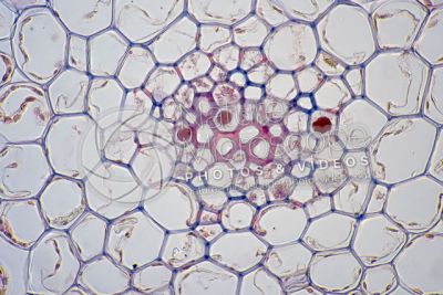 Psilotum nudum. Whisk fern. Stem. Protostele. Transverse section. 500X