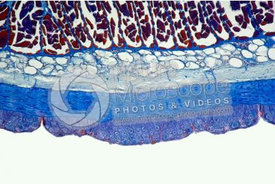 Petromyzon sp. Lampreda. Cute e epidermide. Sezione trasversale. 100X