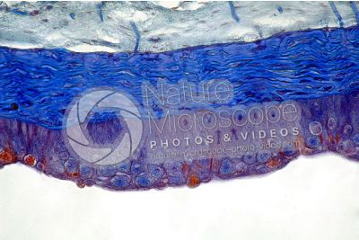 Petromyzon sp. Lampreda. Cute e epidermide. Sezione trasversale. 250X