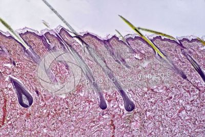 Man. Scalp. Vertical section. 32X