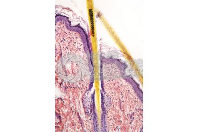 Man. Scalp. Vertical section. 100X