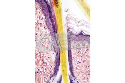 Man. Scalp. Vertical section. 200X