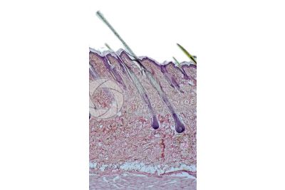 Man. Scalp. Vertical section. 32X