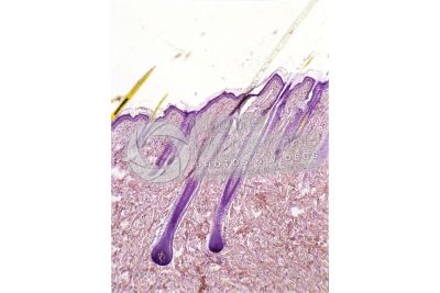 Man. Scalp. Vertical section. 50X