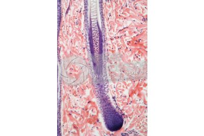 Man. Scalp. Vertical section. 250X